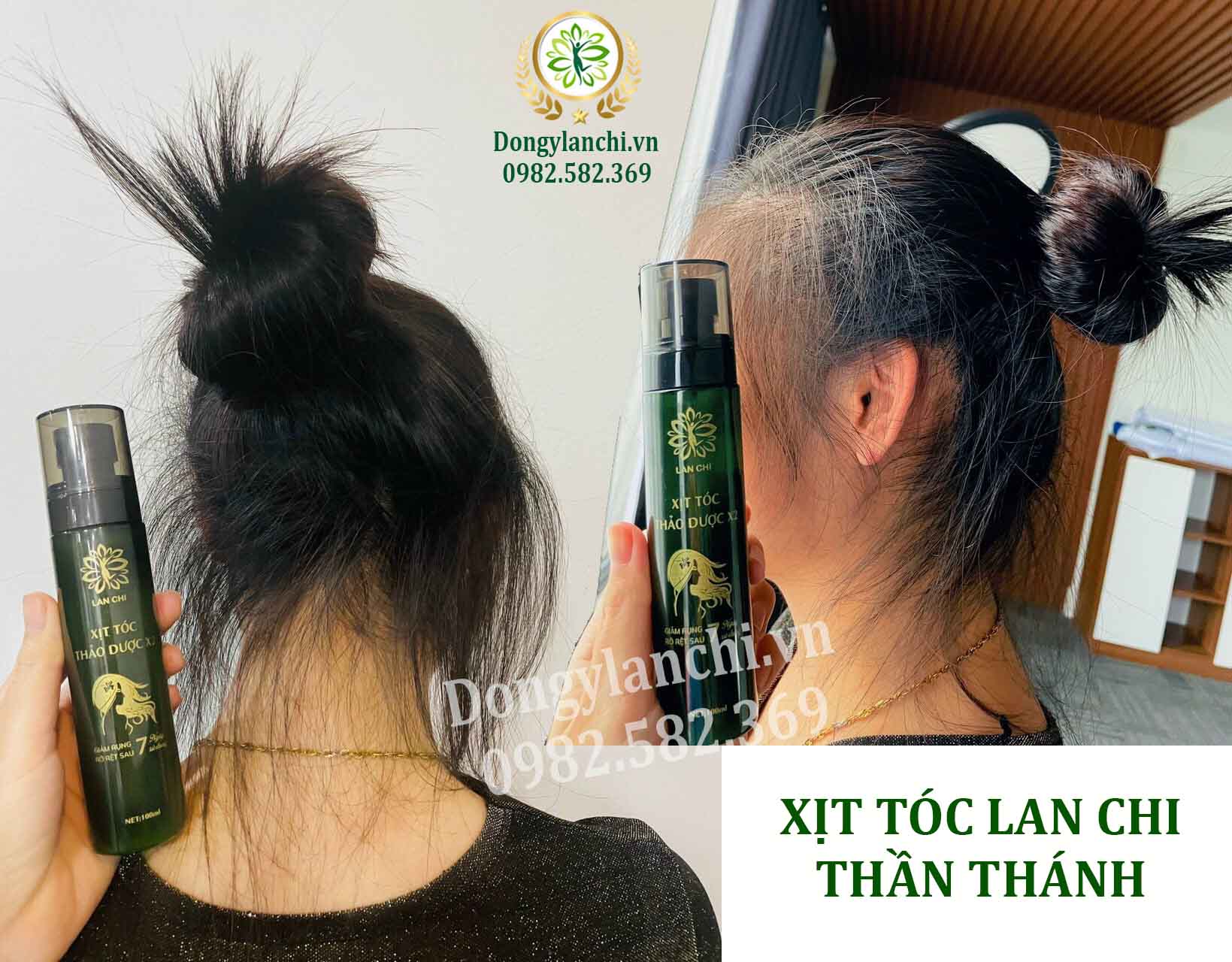 Xịt tóc thảo dược X2 Lan Chi